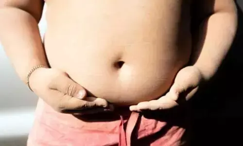 79% Americans think surgery for weight loss should be last resort: Study