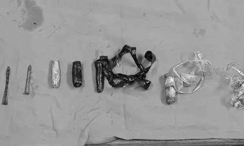 Osmania Gandhi hosp doctors remove nails from prisoner’s stomach