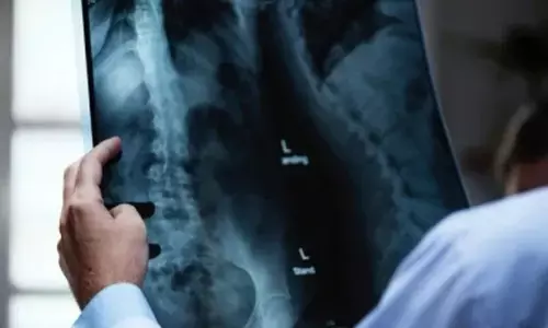 RSV can infect nerve cells, cause inflammation and damage: Study