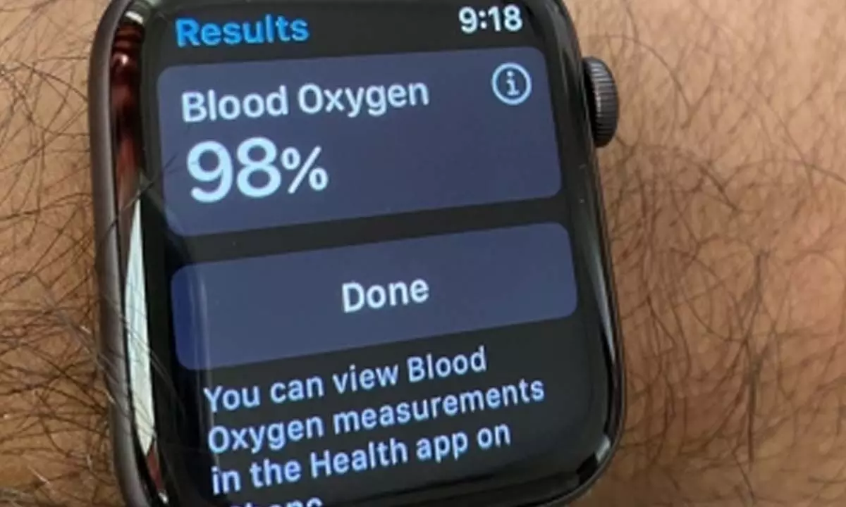 Doctor uses Apple Watchs banned blood O2 feature to save passenger mid-air