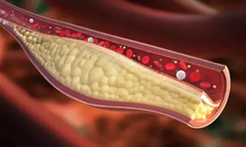 Sclerostin key protein for cardiovascular health in patients with diabetes