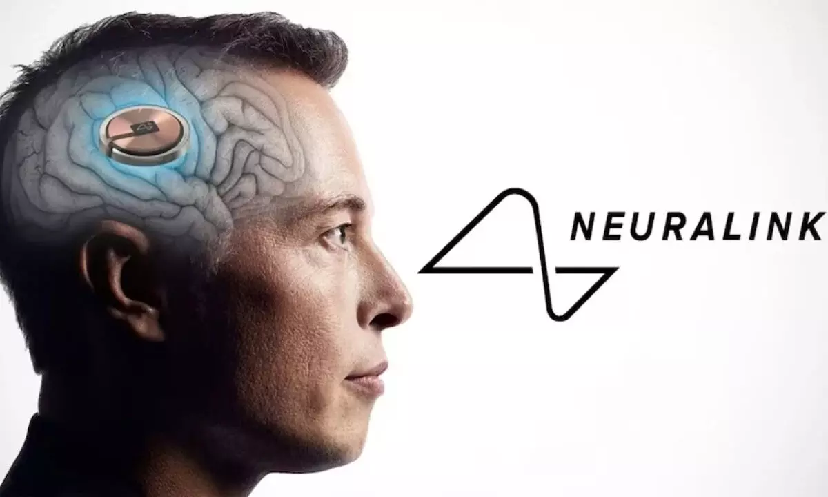 Neuralink Successfully Conducts First Human Brain Chip Implant: Key Details