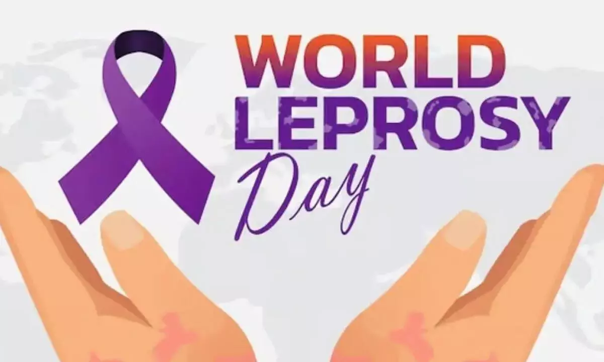 Leprosy Day 2024: History, significance, early signs, symptoms and diagnosis