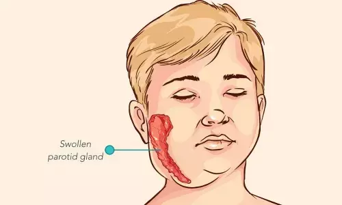 Parents beware, Mpox disease spreading among children