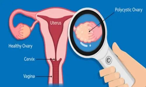 US researchers decode origins of ovarian cancer