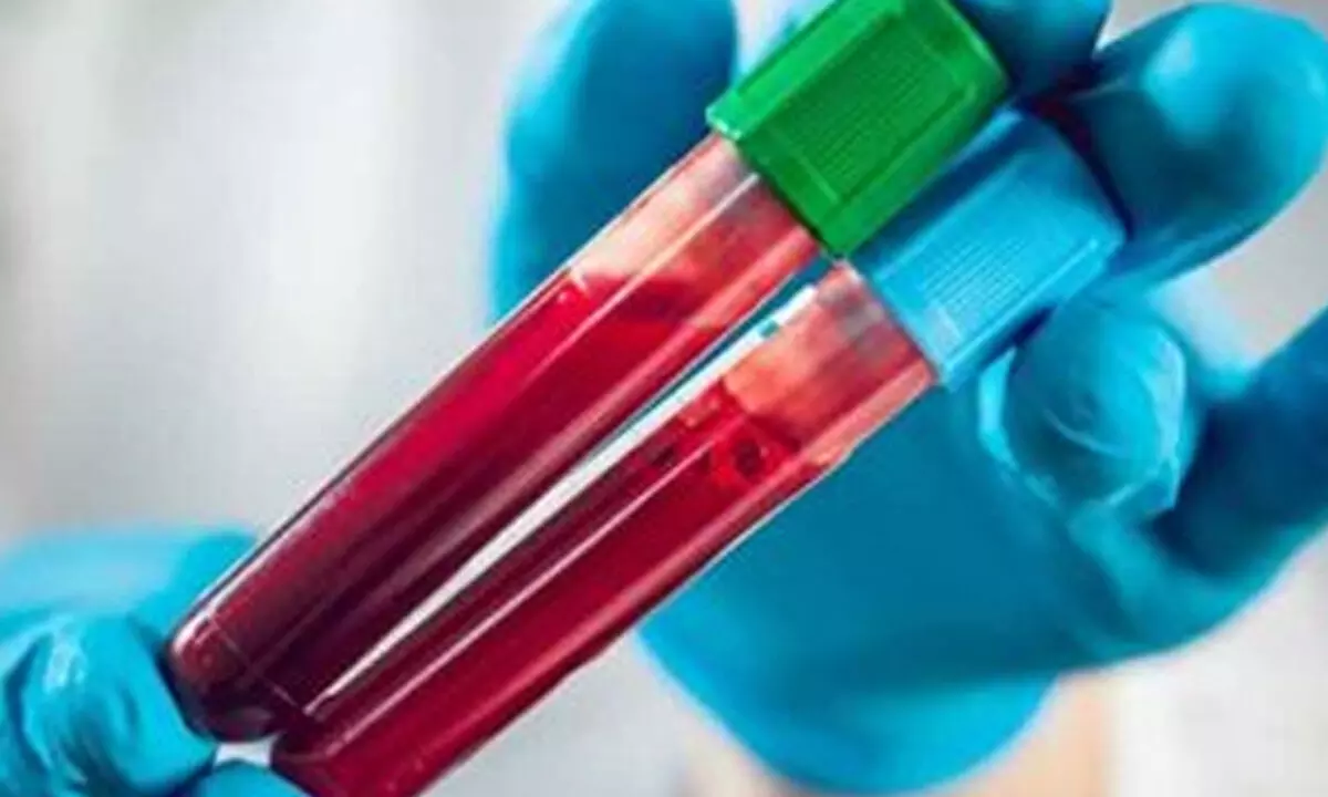 SGPGIMS to provide free DNA testing for hepatitis