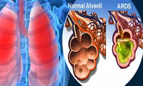 New cell therapy shows promise for Covid-related respiratory distress