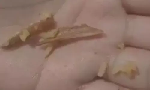 Bone pieces found in Srisailam prasadam