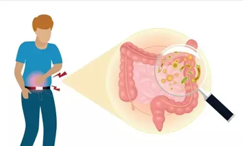 Representational image