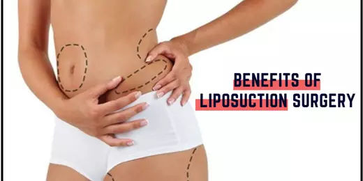 Trimming Away: Exploring The Health And Aesthetic Benefits Of Liposuction