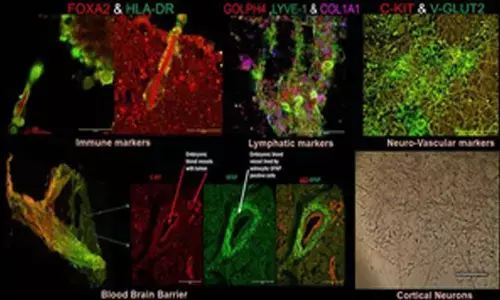 Indian researchers develop organoid to help in neurodegenerative diseases