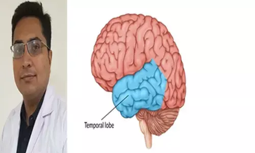 Mumbai woman cured of epilepsy after part of her brain removed