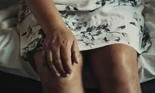 Rheumatic disease risk high up to 1 year post a Covid infection: Study