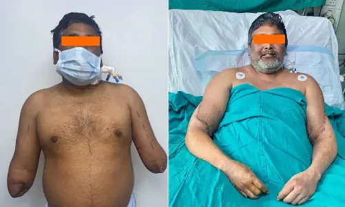 Painter Receives Bilateral Hand Transplant Through  Organ Donation In Delhi