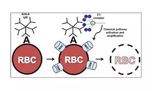 Solving incompatible kidney transplants across blood groups