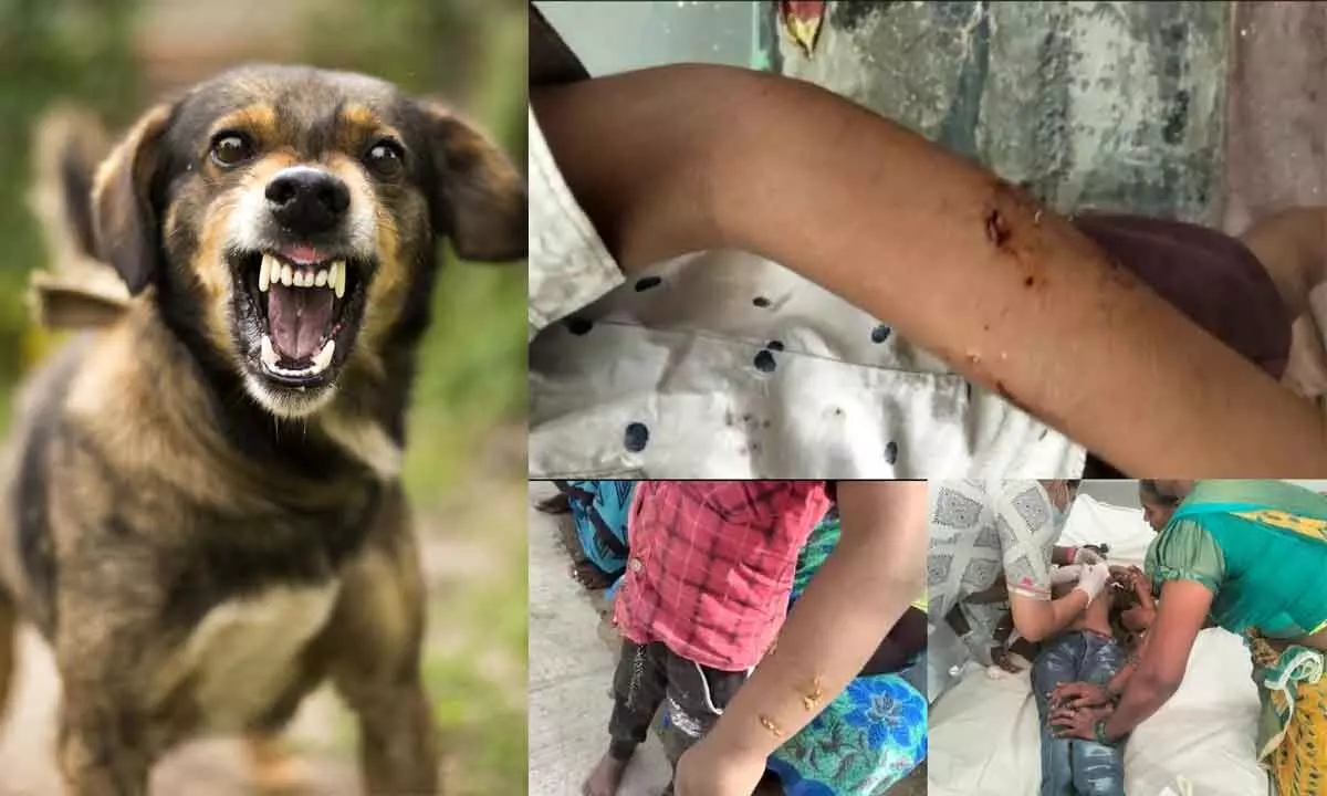 Seven children were attacked by mad dogs
