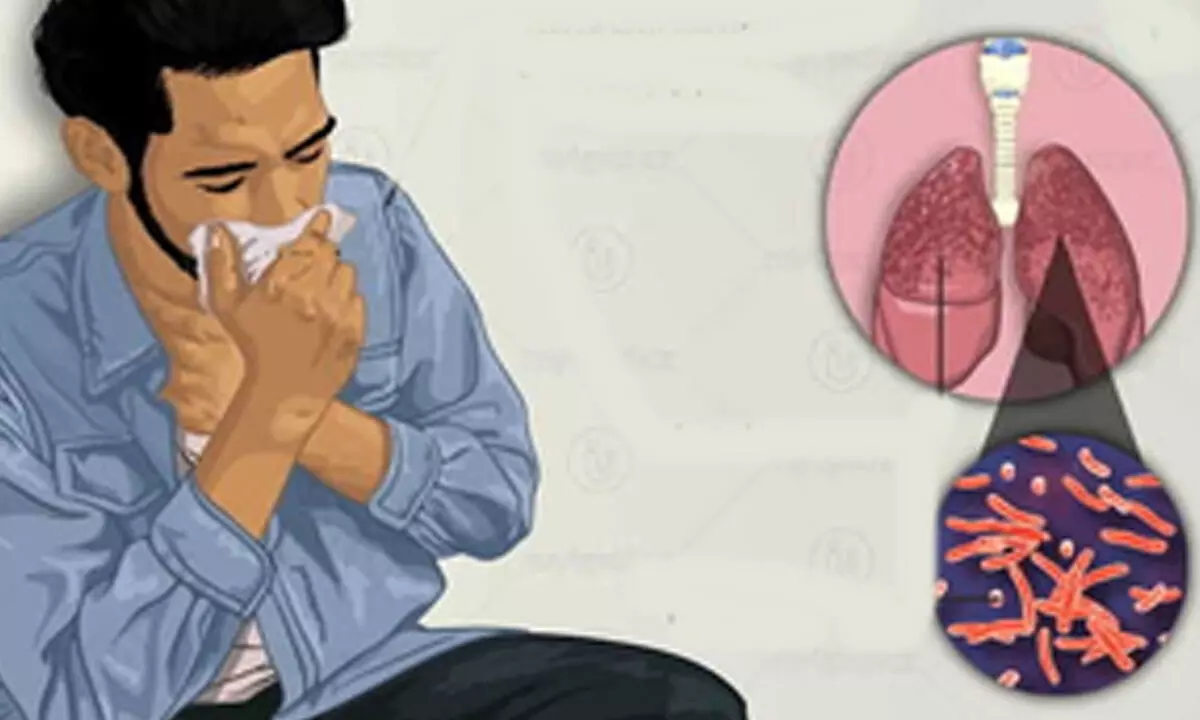 The role of BCG vaccine in preventing TB in children, adolescents