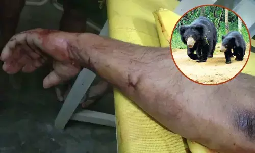 Nagarkurnool: Bear attack on company employee