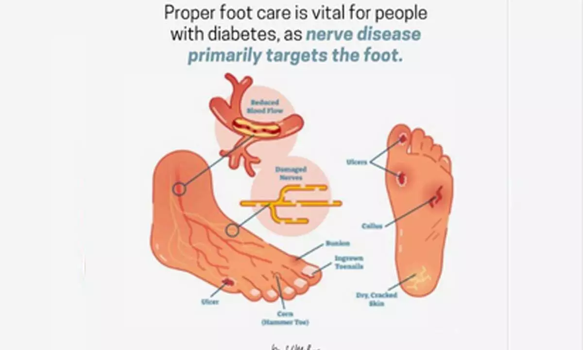 Heres how to take care of your foot health if you have diabetes