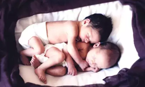 Twins born prematurely at 24 weeks brave hernia, heart defect to survive