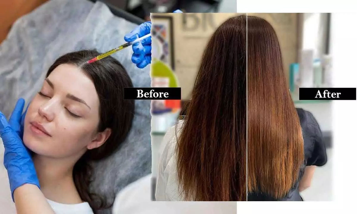 Revolutionising hair care: The rise of Hair Botox