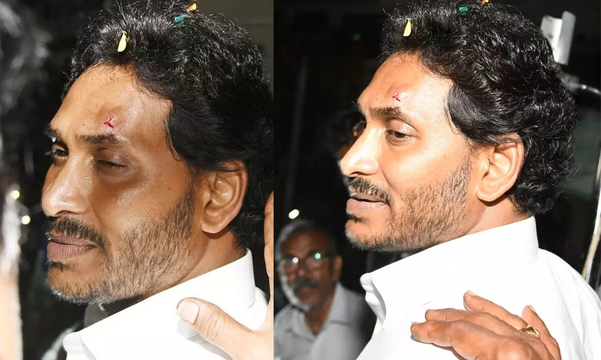 CM Jagan attacked during Memantha Siddham Yatra in Vijayawada