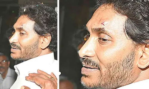Vijayawada: Stone hits Jagan during road show