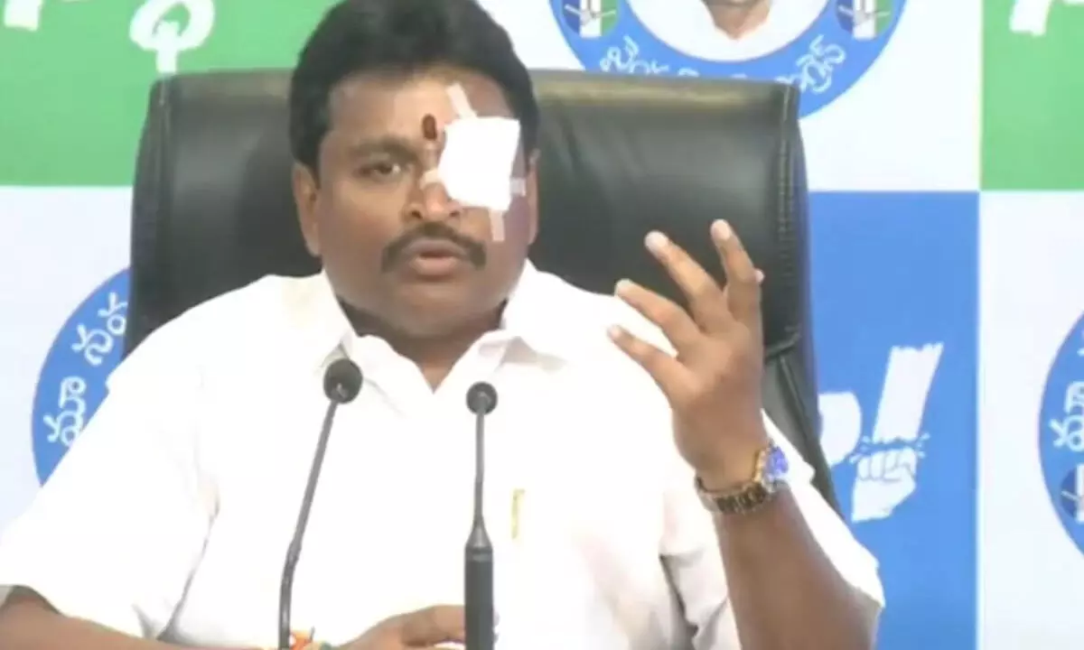 Vellampally Srinivasa accused TDP of attacking YS Jagan