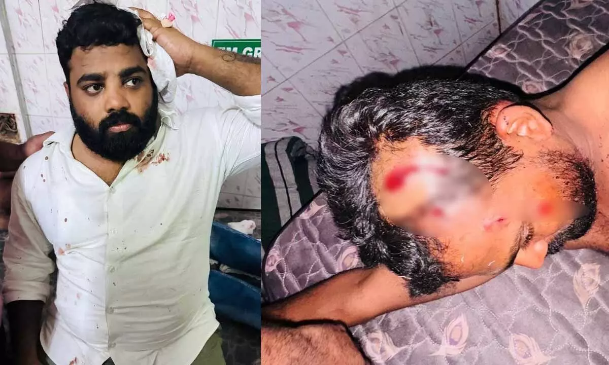 6 YSRCP activists injured in attack by TDP men