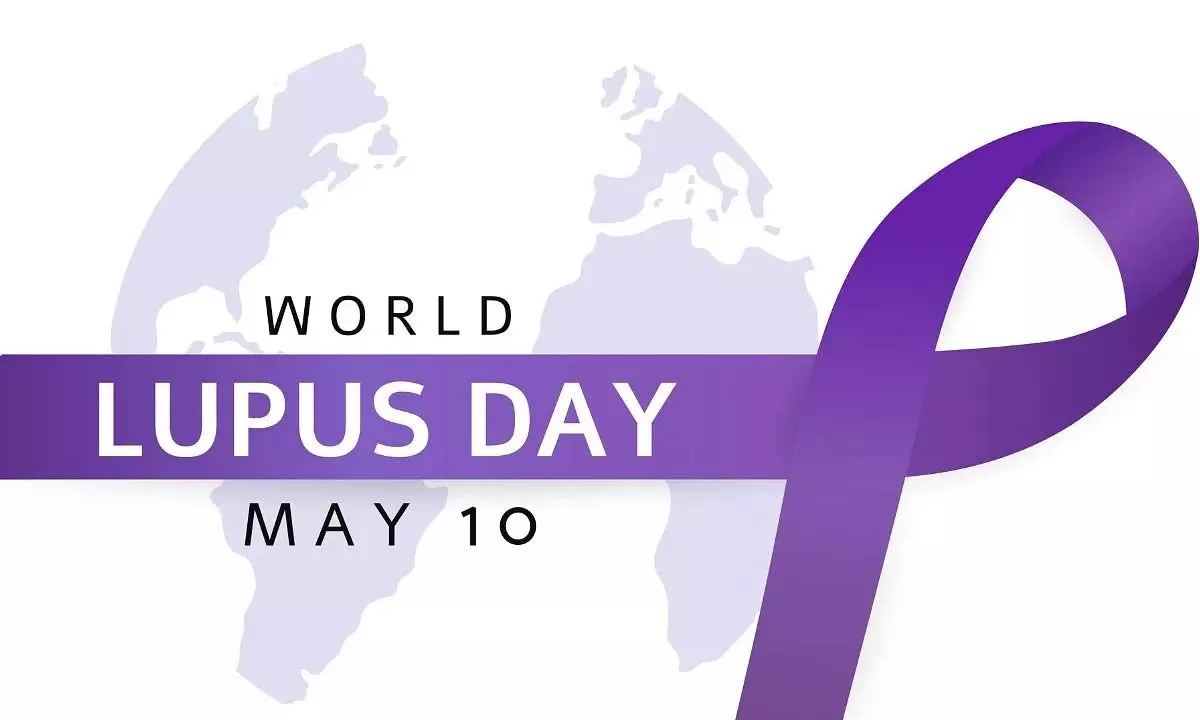 World Lupus Day 2024: Date, History, Significance, and Facts