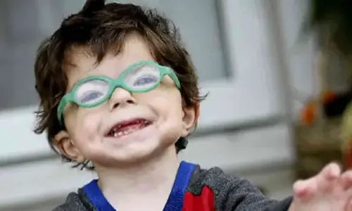 International Cornelia de Lange Syndrome (CdLS) Awareness Day 2024: Date, history, significance