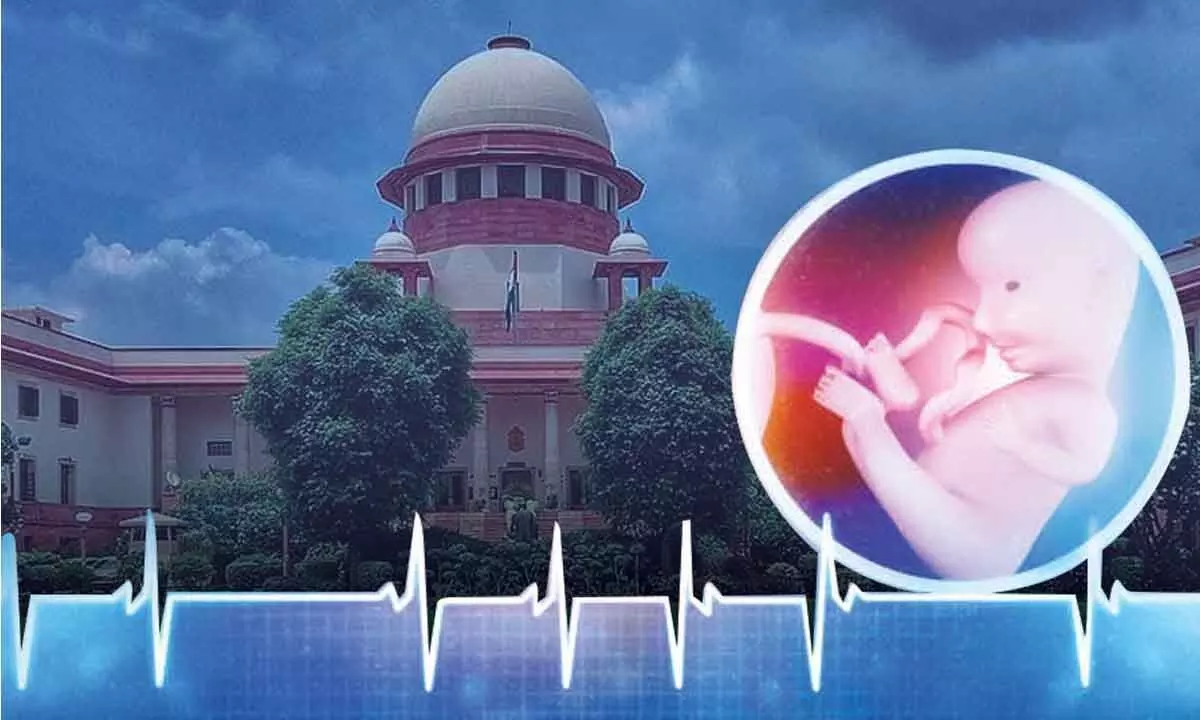 Foetus has fundamental right to live: SC rejects termination of over 27-week pregnancy