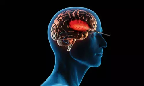 Chennai docs ace world-1st keyhole surgery for insular brain tumour via eyebrow