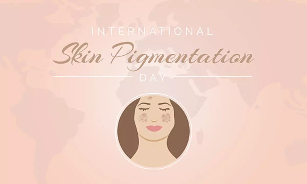 International Skin Pigmentation Day 2024: Date, history, significance