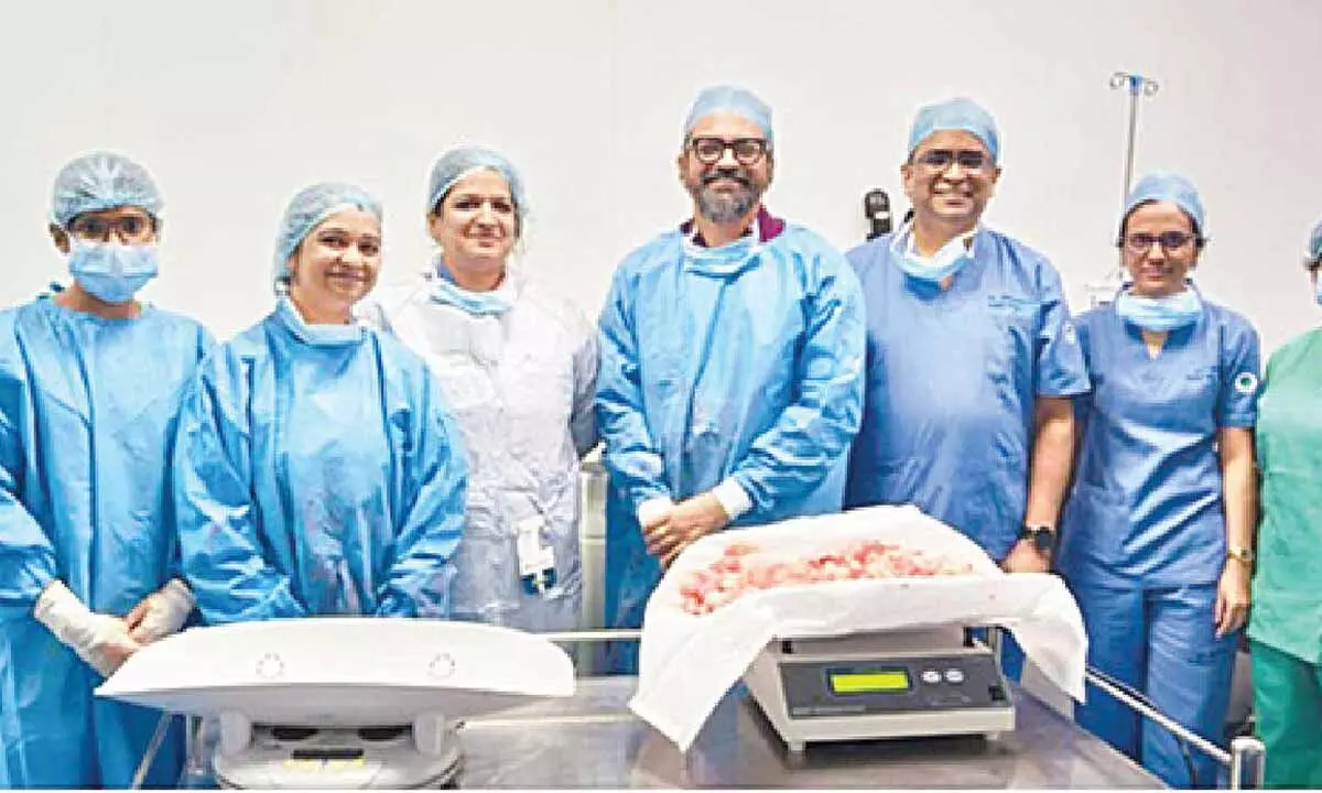 In a first in south India, 4-kg fibroid uterus removed through surgery