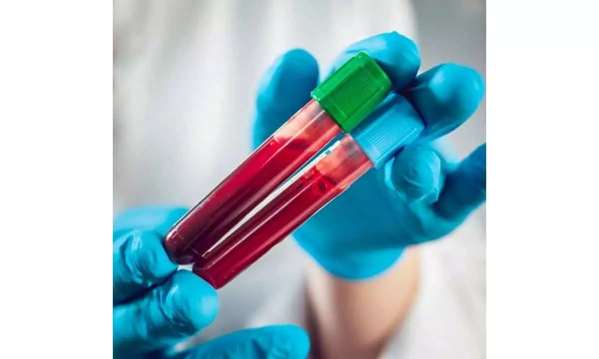 Blood cancer cases may be rising among young adults in India, say experts