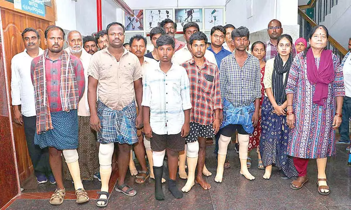 Artificial limbs distributed