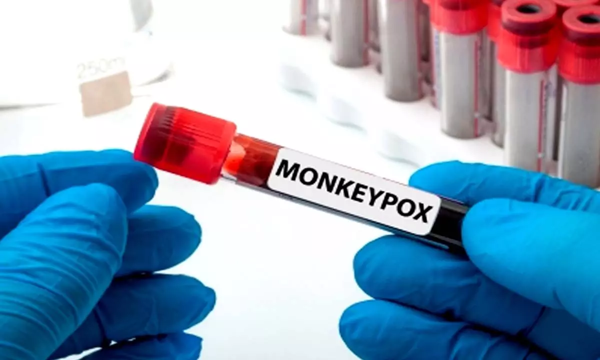 South Africa on high alert after five confirmed cases of monkeypox