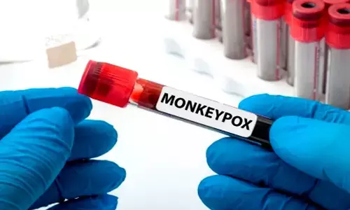 Malta joins other EU states to curb monkeypox spread in Africa