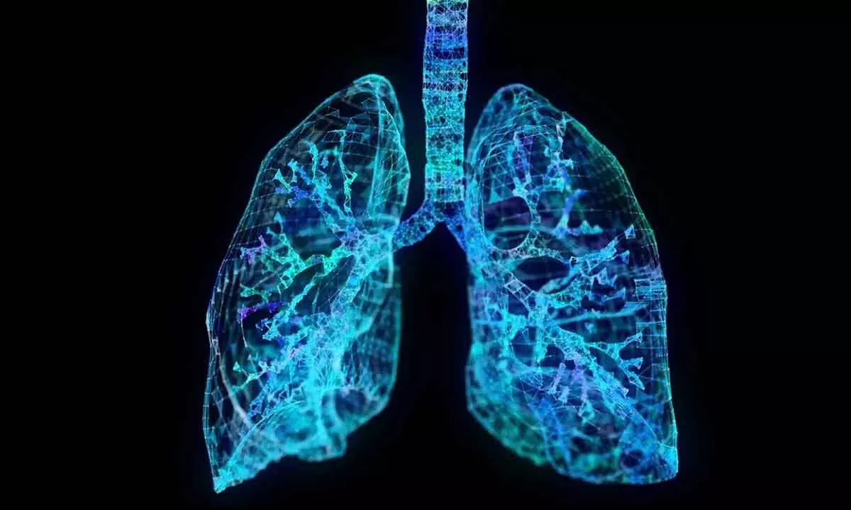 Study decodes how pathogens infect human lung tissue