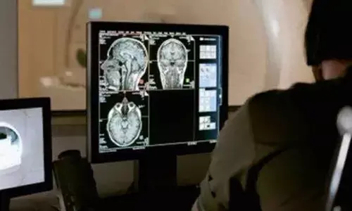 How brain scans can give distorted readings in some people