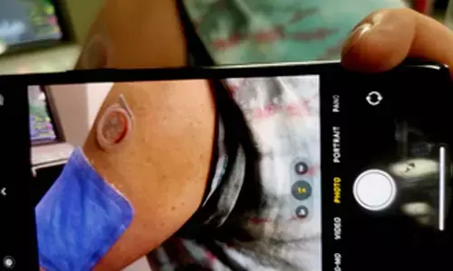 Researchers develop wearable device that measures levels of disease markers via sweat