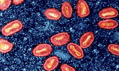 New Mpox Clade 1b worrying, can spread via physical contact, raise mortality rate