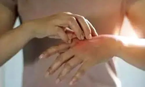 Hand, foot and mouth disease at warning level in Japan