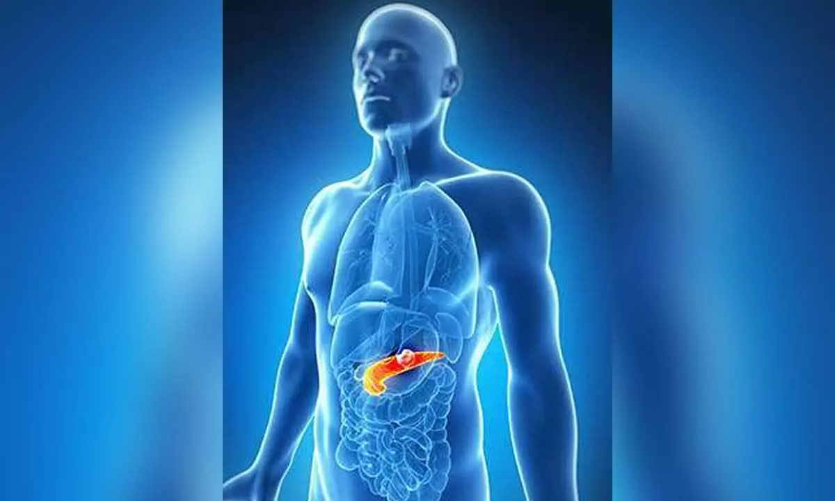 Novel method to counter chemotherapy resistance in pancreatic cancer developed