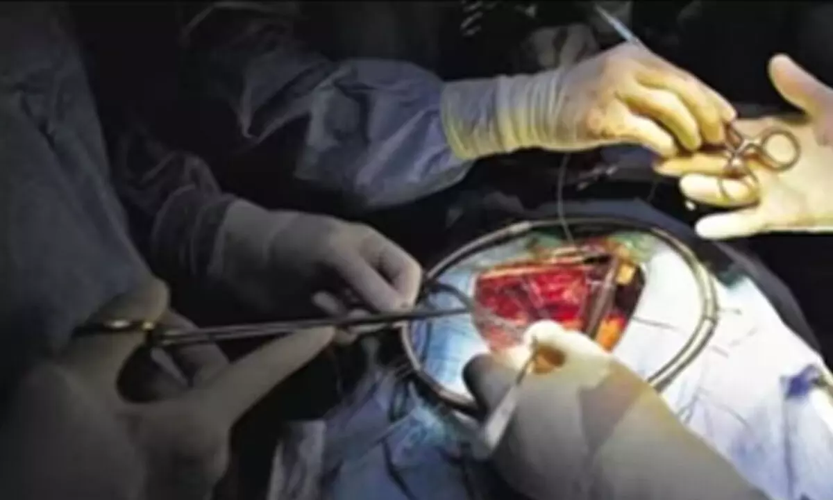 Doctors remove giant abdominal tumour bigger than a football weighing 7.5 kg