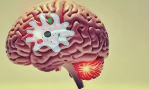 Monsoons may trigger brain infections in Indians living in coastal areas, rice belts