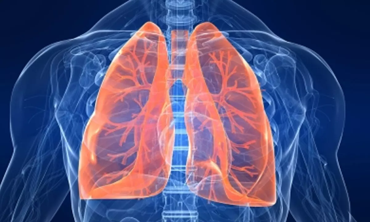 Why are most lung cancer patients in India non-smokers?