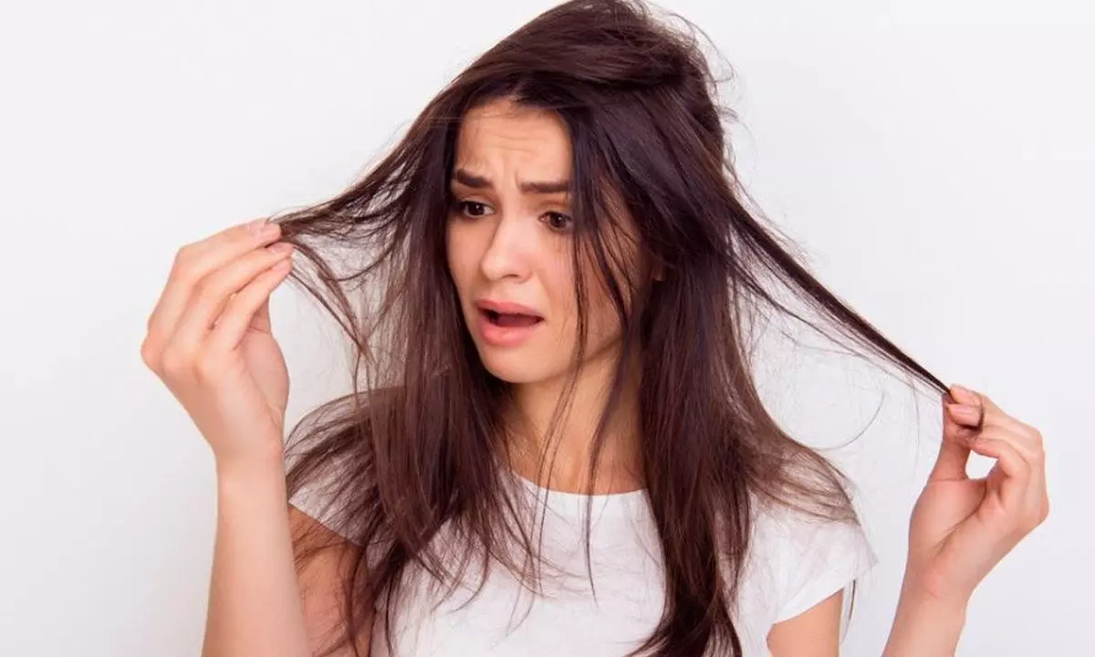 A total recipe for monsoon hair problems