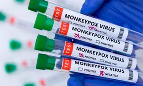 27 confirmed cases of Mpox, 1 death reported from India since 2022: WHO